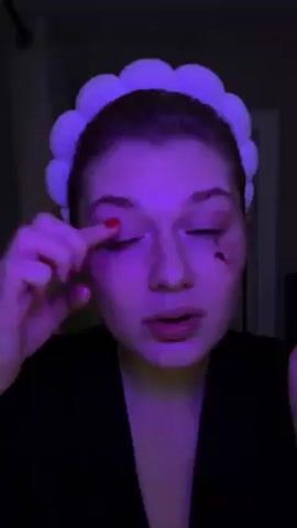 A person with red nail polish is on camera. They have a white, fluffy headband. Their left eye appears to have red makeup around it. There is a wound or scar on their right cheek. The room is dimly lit in purple. The person uses their fingers to spread open their eyelids. They are centered in the frame. There is loud music playing in the background.