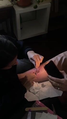 Wound care treatment documented in Buenos Aires