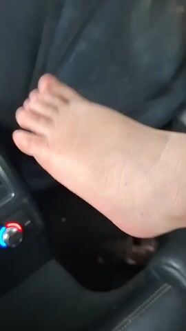 The video shows a close-up of a person's swollen foot, likely an ankle, inside a car. The foot is pale and appears to be resting on a dark surface, possibly a car seat or floor. The individual's toes are visible, and the skin looks stretched due to the swelling. The background is blurry, but hints of a car's interior are discernible, including a dark seat and some controls. The foot is moved slightly throughout the clip, revealing more of its shape and the extent of the edema.
