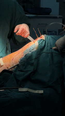 Surgical procedure recorded in Yuzhong District early morning