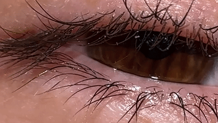 Unknown witness captures detailed eye photographs in 11-minute sequence