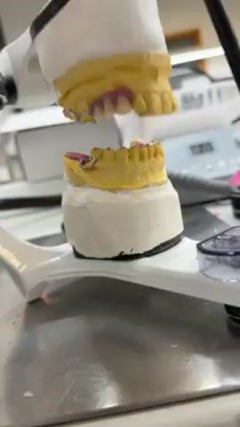 The video presents a close-up view of a dental articulation device, holding dental molds of the upper and lower teeth. The molds are yellow and coated with a pink substance around the gum area. A silver-colored metal framework is attached to the lower mold. The device is primarily white, mounted on a metal surface. The camera is stable, focusing on the articulation device and molds, with a shallow depth of field blurring the background which features some medical equipment. A black object moves slightly in the background and then in the foreground.