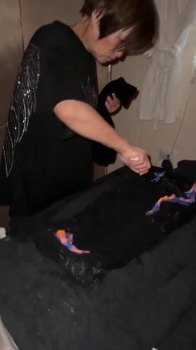 Fire therapy treatment documented in Abakan spa session