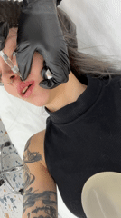 Cosmetic procedure performed on tattooed woman in Khimki facility