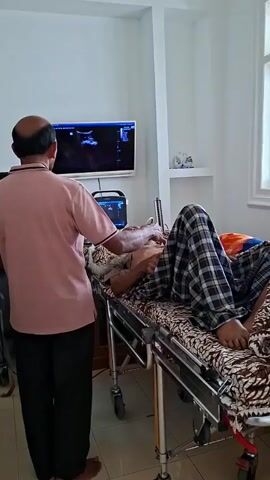 A man is giving an older man an ultrasound in what appears to be a hospital room. The older man is lying on a hospital gurney, covered in blankets, wearing a plaid pajama bottom.  The man giving the ultrasound is wearing a salmon colored t-shirt and black pants. He stands to the side of the gurney, looking at a screen that is displaying ultrasound results while holding the wand to the man's chest. There is a smaller monitor that also displays the ultrasound results sitting on the cart next to the gurney. Behind the gurney is a white wall with a small, white shelf holding a small decorative item. A window is to the right of the shelf.