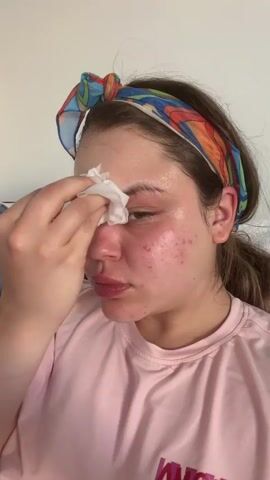 A young woman with a colorful headband wipes her face with a damp cloth. She has fair skin with red patches and acne breakouts on her cheeks. She is wearing a pink t-shirt and her hair is pulled back into a ponytail. The background is a white wall with some laundry visible on the left side. The lighting is soft and natural. She looks directly at the camera while wiping her face.