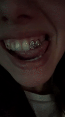 Person displays decorative dental grill in Sofia
