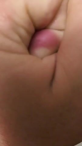 The video is a close-up shot of a clenched fist. The skin of the knuckles is red and inflamed, indicating irritation or injury. The background is out of focus, but appears to be a neutral color, possibly a wall or fabric. There are no other people or objects visible in the frame. The lighting is adequate, allowing for a clear view of the hand and its condition. The video is brief, lasting only a few seconds, and appears to be an unaltered recording with no visual effects or editing.
