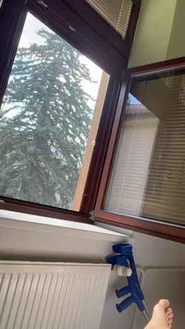 The media file shows a first-person perspective from a hospital bed in Tábor, Czechia. In the foreground, a person's legs are visible, with one foot bandaged. A blue crutch rests against a white radiator. The background features a window looking out onto a tall tree and a building. Inside the room, there are blinds on the window, cabinets, a small refrigerator, and a white bed with white linens. The overall impression is that of a patient recovering from an injury. The lighting suggests it is daytime.
