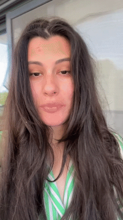 Woman with facial redness spotted on Kiryat Bialik balcony