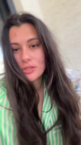 Woman with facial redness spotted on Kiryat Bialik balcony