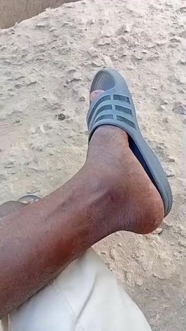 The video begins with a close-up of a person's bare leg and foot, wearing a dark grey slide sandal with three horizontal stripes on the strap. The foot is resting on uneven, light-colored, dusty ground.

The camera then pans up and across, revealing a broad, unpaved dirt road or open area in a daytime setting. Two long, shallow, open ditches or trenches cut across the ground in the mid-ground, suggesting a drainage system or part of a construction project. In the background, several simple, single-story buildings with corrugated metal roofs and unpainted or roughly finished walls line the sides of the street. Some piles of debris or materials are visible near these structures. A few dark vertical poles, possibly utility poles, are present along the road. The scene depicts a dusty, semi-urban or rural environment in Dakata, Nigeria, under bright, clear daylight conditions. There is no visible text other than the design on the slipper.