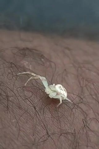 A small white spider with brown markings is crawling on dark brown skin. The skin is covered in dark hair, which is visible throughout the frame. The spider is positioned in the center of the frame and appears to be walking to the right. The background is a blurry dark color, likely the rest of the person's body.