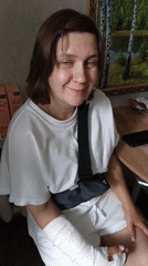 Cast on the arm, cake on the table, thumbs up