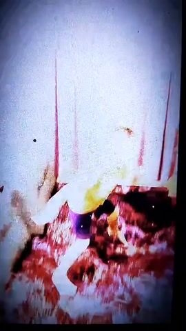 The video begins with a static image of what appears to be a wound or injury, showing exposed flesh and blood. The scene then transitions to a person, seemingly male, wearing a yellow shirt and purple shorts. The person is in a distressed or injured state, exhibiting movements that suggest pain or struggle. The environment appears to be indoors, with a rough, possibly damaged wall in the background. The overall impression is one of violence or injury.