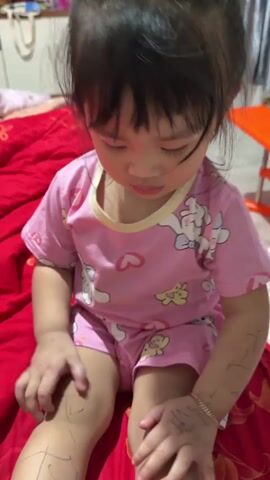 A child wearing a pink shirt with cartoon characters is sitting on a red blanket and appears to be scratching their arm and leg. The child's face is partially obscured and the video is blurry. The background shows a room with a white wall and a glimpse of furniture.