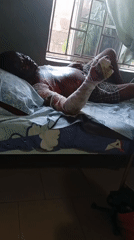 Burned individual observed recovering in bedroom bed