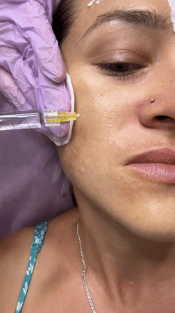 Woman receives facial injections, skincare treatment in Nha Trang