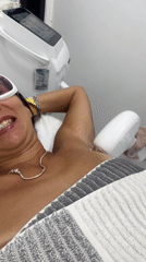 Late-night laser treatment session documented at Indonesian medical clinic