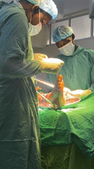 Ankle surgery with external fixator performed in Nairobi