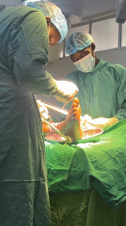 Ankle surgery with external fixator performed in Nairobi