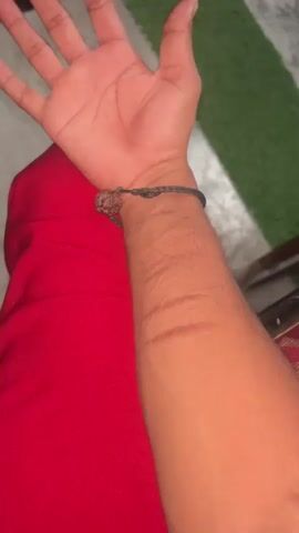 The video shows a close-up of a person's left forearm, which is resting on a red fabric. The forearm exhibits several horizontal scars. The person is wearing a dark string bracelet with a brown bead on their wrist. The background is blurred, with hints of green and grey.