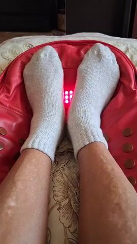 A close-up, top-down view of a person's bare legs and feet, wearing light gray socks, resting on a red massager. The massager has a panel with several red lights that are illuminated. The person's legs have patches of lighter skin, suggesting a skin condition like vitiligo. The background appears to be a bed with a patterned comforter.