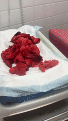 Medical procedure aftermath documented in Tourcoing, France