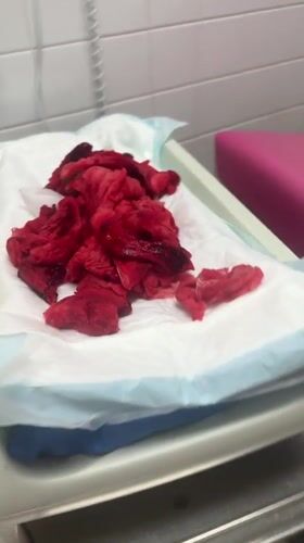 Medical procedure aftermath documented in Tourcoing, France