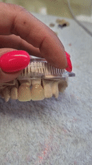 Person handles dental model with fuchsia nails in Suffolk