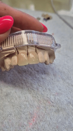 Person handles dental model with fuchsia nails in Suffolk