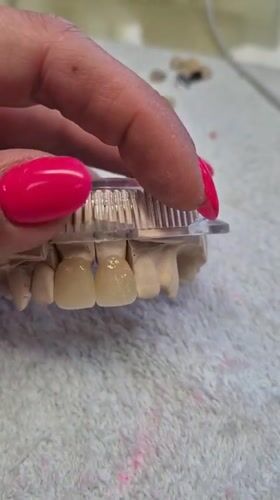 Person handles dental model with fuchsia nails in Suffolk