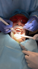 Routine dental procedure documented at Tbilisi clinic