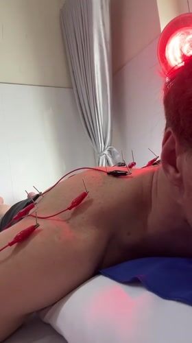 Person receives electroacupuncture treatment in Nha Trang, Vietnam