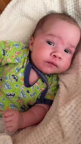 This video is a close-up shot of a baby lying down on a textured, cream-colored blanket. The baby is wearing a green short-sleeved onesie with a pattern of cartoon cars and stars. The baby's head is tilted slightly to the right, and they are looking towards the camera with an open mouth. The baby's skin is flushed, and there are some red marks visible on their forehead and cheeks. The lighting appears to be natural and soft. The focus is on the baby's face and upper body.