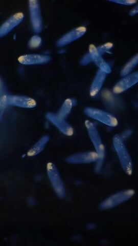 The video shows a microscopic view of numerous translucent, elongated shapes, each with a bright yellow or orange tip. These shapes are set against a dark background. The scene then transitions to a gloved hand adjusting a glass slide on the stage of a Levenhuk MED Series microscope.