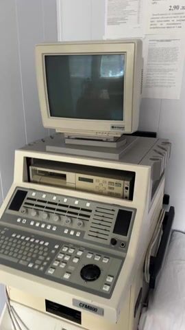 The video shows an older medical ultrasound machine, likely from the late 1980s or early 1990s. The machine is off-white or beige and consists of several stacked components. At the top is a CRT monitor displaying a slightly blurry image. Below the monitor is a component with a Sony label, possibly a video or data recorder. The main control panel features numerous buttons, knobs, and sliders, along with a small keyboard. The model name "CFM800" is printed on the front. At the bottom is a section with electrical connections and possibly storage space. The machine is on wheels and stands next to a bed or examining table with white linens in what appears to be a medical facility or clinic. There is a piece of paper taped to the wall. There's a sticker of a heart decorated with pink flowers, attached to the lower part of the machine.