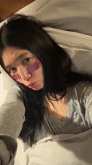 Woman documents skincare routine with eye patches in Essen