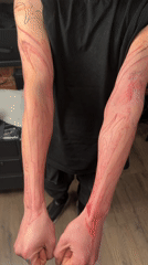 Person displays red tattoo stencils on forearms in Moscow