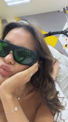 Woman takes playful selfies during laser treatment in Krasnoyarsk