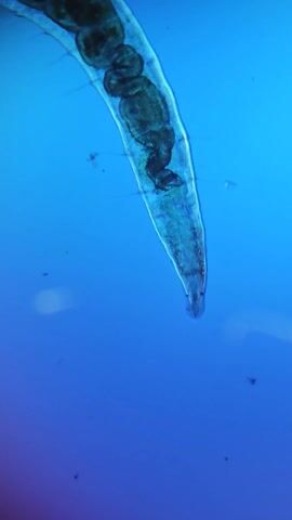 The video shows a microscopic view of a translucent, segmented worm-like organism. It appears dark in the upper portion with several globular structures. The lower portion is more transparent and tapered. The background is a uniform blue. There are a few specks scattered around the organism in the blue field.