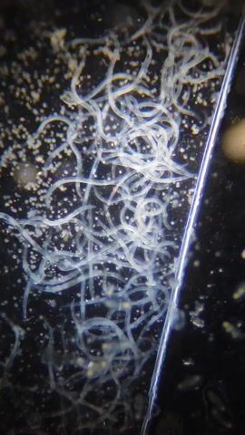 A close-up shot shows numerous thin, translucent, and squiggly worm-like organisms. They appear to be massed together on a dark surface, with several smaller, bright, and round particles scattered around them. A bright, thin, vertical line is present on the right side of the frame, potentially an edge or a reflection.

The perspective shifts to a wider shot, showing a hand in a blue glove manipulating a glass slide on the stage of a microscope. The microscope is primarily white and black, and the light source is directed onto the slide. The slide itself appears to hold the sample seen in the previous close-up. The words "glazami microscopa" are visible on the side of the microscope.