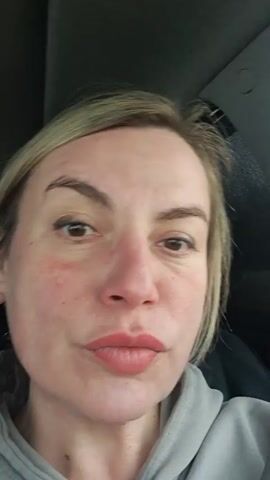 A woman with light brown hair and a gray hooded sweatshirt is sitting in a car, looking directly at the camera with a slight pout. She has fair skin with some redness on her cheeks and around her nose. She is wearing a seatbelt. There is music playing in the background.