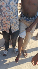 Man receives assistance for foot injury on Dar es Salaam street