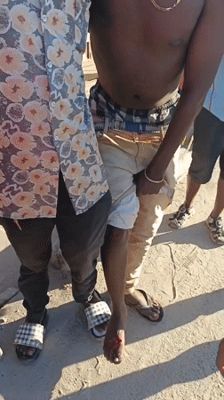 Man receives assistance for foot injury on Dar es Salaam street