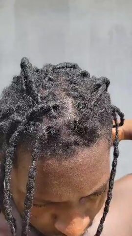 The video shows a close-up of a person's head with black dreadlocks. A hand can be seen touching the hair, spreading it apart. The background appears to be a plain gray wall. The lighting is bright and clear, illuminating the texture and details of the hair and skin. The person's face is mostly out of frame, showing only the forehead and part of the cheek. The focus is on the hair and the hand manipulating it.