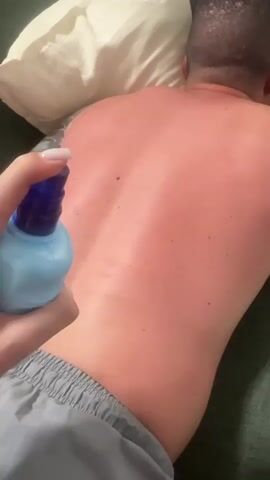 A person's hand, holding a blue spray bottle, sprays a substance onto the back of another person who is lying face down on a couch. The back of the person on the couch is visibly red, suggesting sunburn. The spray bottle has a blue cap and a light blue body. The hand has painted fingernails. The person on the couch is wearing grey shorts. There is a white pillow behind the person's head. The couch appears to be green.