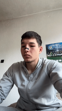 Young Man Records Multiple Selfies With Nose Bandage in Bulgaria