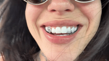 Woman with gold sunglasses and silver grill photographed in Roncade