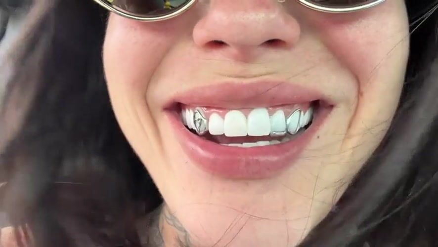 Woman with gold sunglasses and silver grill photographed in Roncade
